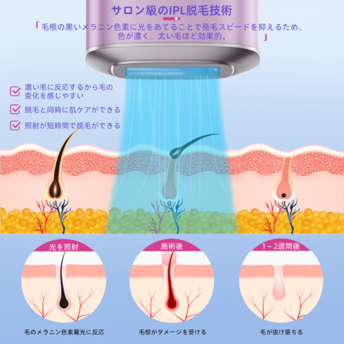 Arsupen 脱毛器 IPL 光美容器 冷却 ワキ メンズ レディース 男女兼用 全身 ムダ毛 美肌 全身脱毛 サロン級 光脱毛器 家庭用脱毛器 自動照射 冷感 - 画像 (2)